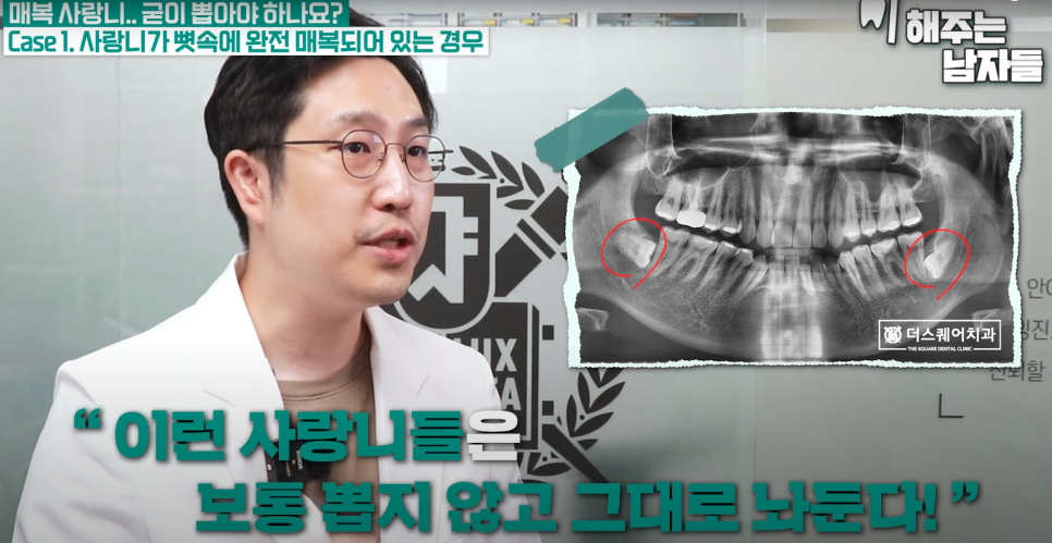 경복궁역사랑니, 안 보이는 사랑니도 발치가 필요한가요? 관련 이미지 9