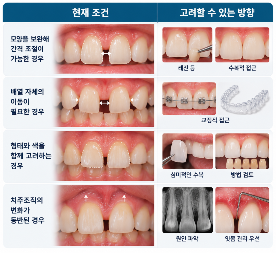 종로 치과, 앞니벌어짐이 생기는 이유 관련 이미지 10