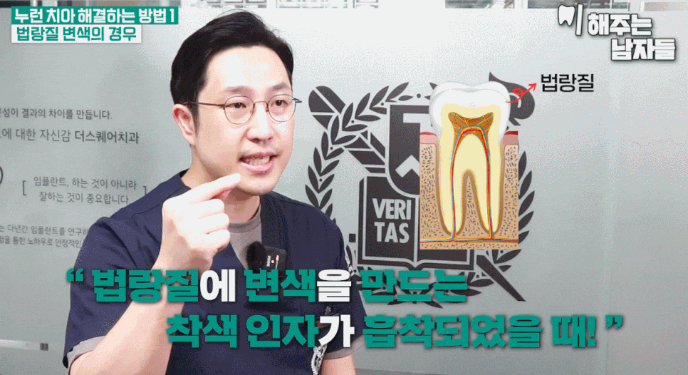 How to Whiten Yellow Teeth with Teeth Minish vs. Teeth Whitening Treatment image 9