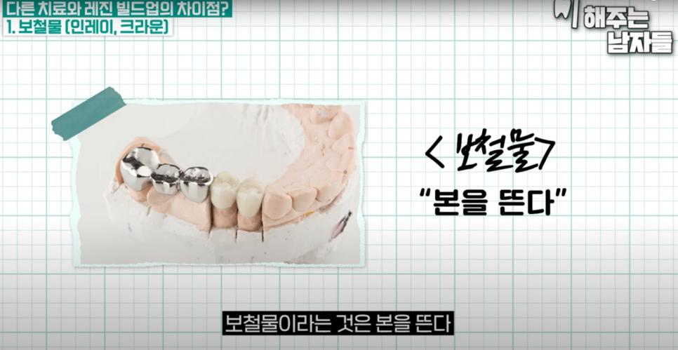 마포충치치료 당일에 끝나는 충치치료, 레진 빌드업이란? 관련 이미지 4