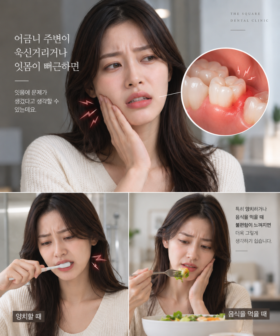 어금니잇몸통증, 잇몸이 욱신거린다면 확인할 3가지 관련 이미지 2
