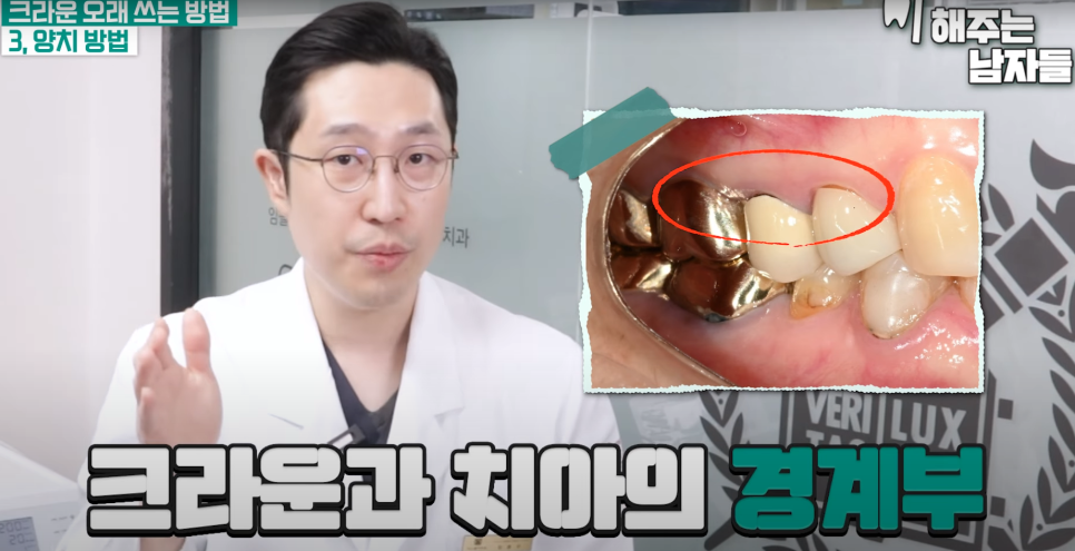 소곡동충치치료 크라운, 오래 쓰려면 꼭 지켜야 할 3가지 관리법 관련 이미지 4