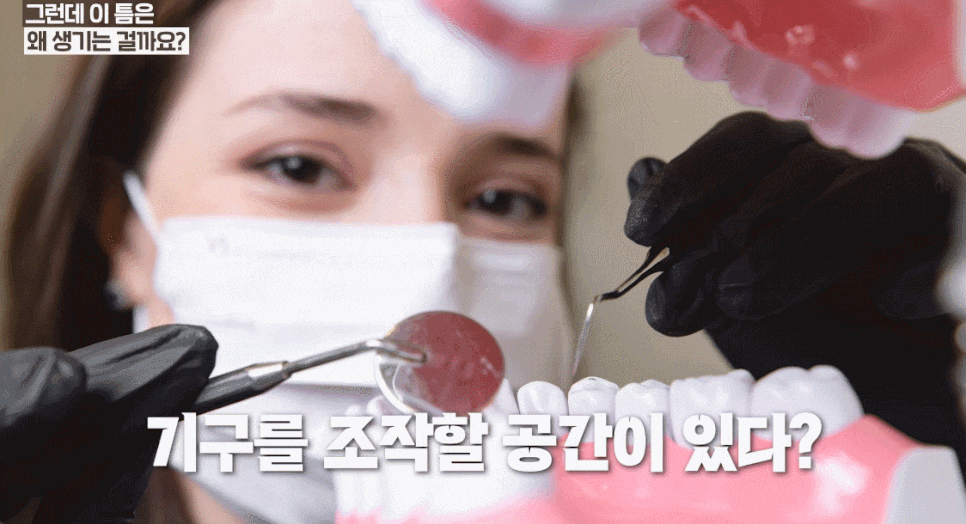 앞니사이벌어짐, 1mm의 선택이 인상을 좌우합니다. [레진빌드업치과] 관련 이미지 6