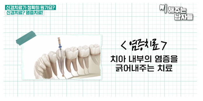 신경치료 vs 임플란트, 어떤 기준으로 나뉠까요? 관련 이미지 2