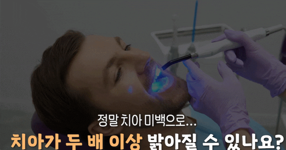 누런치아 하얗게 하고  싶다면? 자가미백 전에 관련 이미지 2