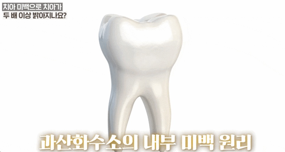 누런치아 하얗게 하고  싶다면? 자가미백 전에 관련 이미지 4