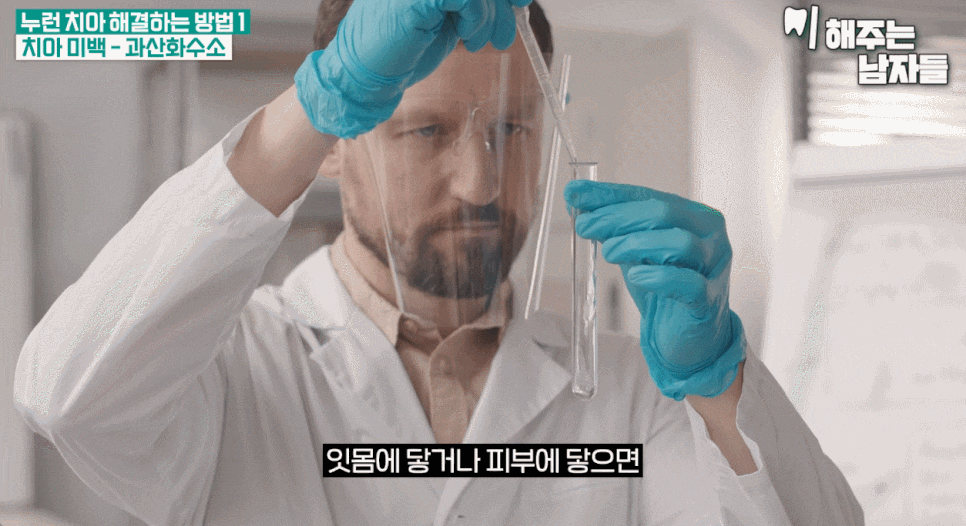 How to Whiten Yellow Teeth with Teeth Minish vs. Teeth Whitening Treatment image 11