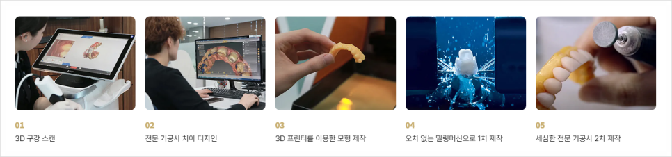 누런치아 고민에 치과 미백부터 미니쉬치료까지 한 번에 정리 관련 이미지 13