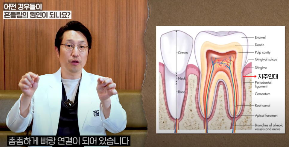 안국역임플란트 흔들리는 치아, 살릴 수는 없을까요? 관련 이미지 3