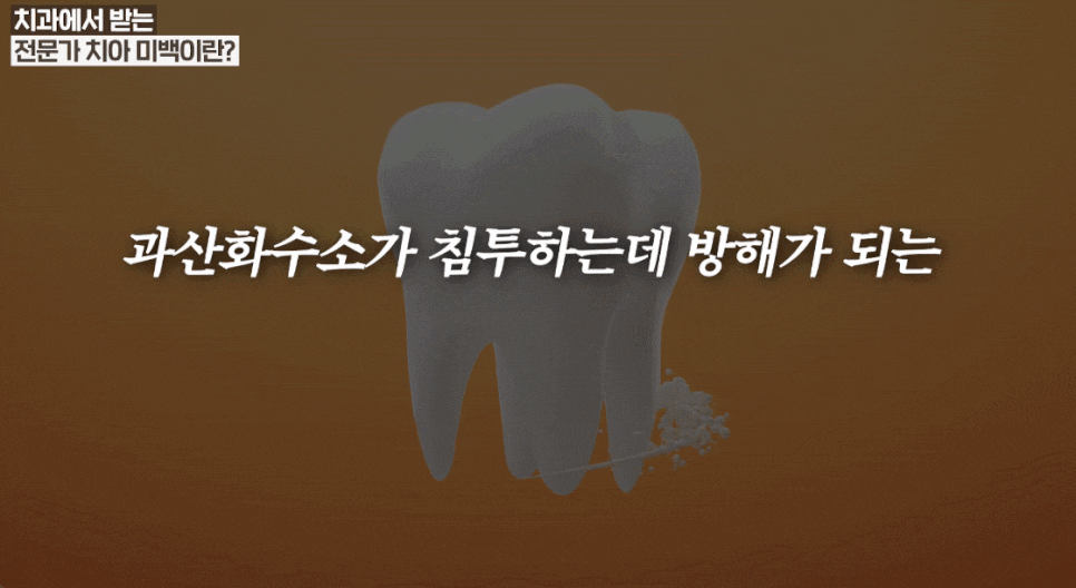 Foods After Teeth Whitening <Everything About Professional Teeth Whitening at the Dentist> image 9