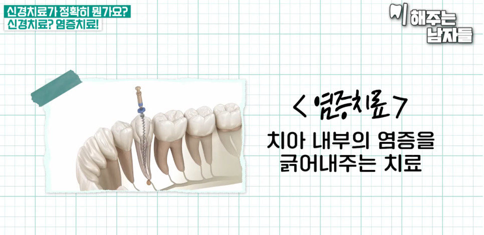 신당역치과 충치치료 시 신경치료는 필수일까? 관련 이미지 2