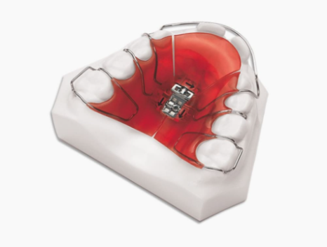 소아치아교정, 지금 시작해야 할까요? 관련 이미지 7