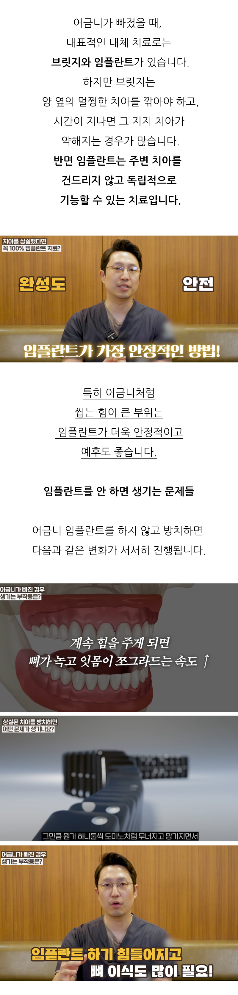 종각치과 어금니빠짐 안정적인 관리를 위해 관련 이미지 3