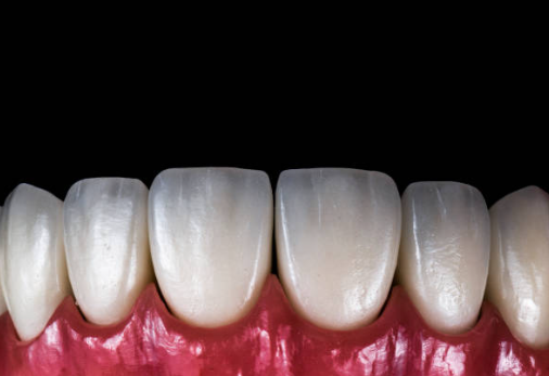 앞니 크라운 교체 시점, 앞니 크라운 수명이 아니라 &lsquo;이 기준&rsquo;입니다. 관련 이미지 7