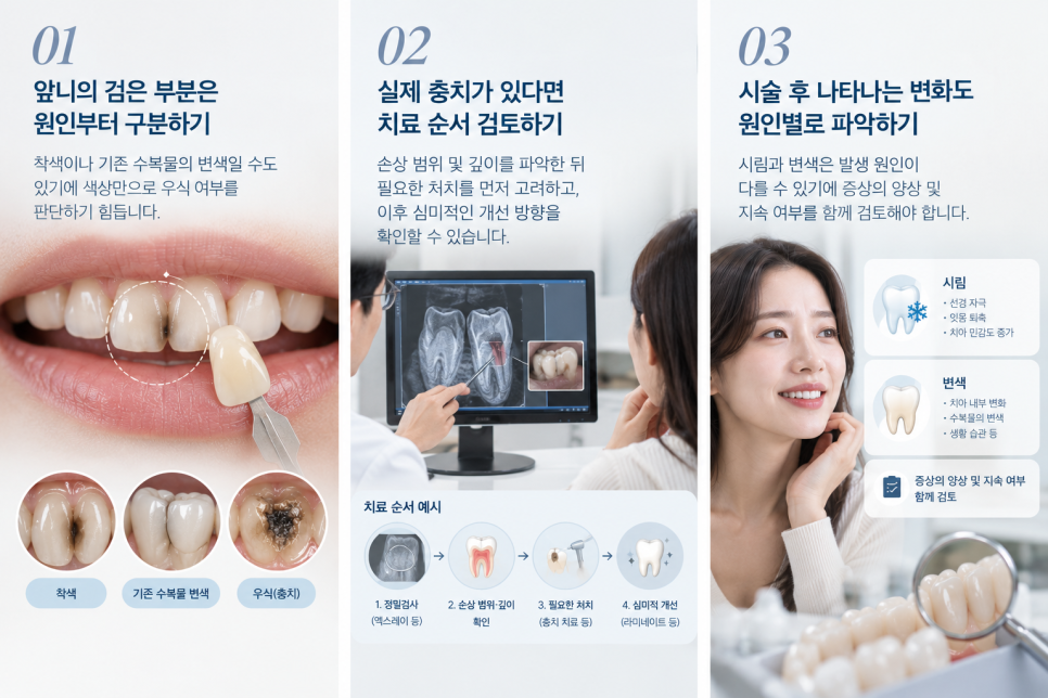 치아라미네이트, 충치 증상 있다면 먼저 확인할 것은? 관련 이미지 14