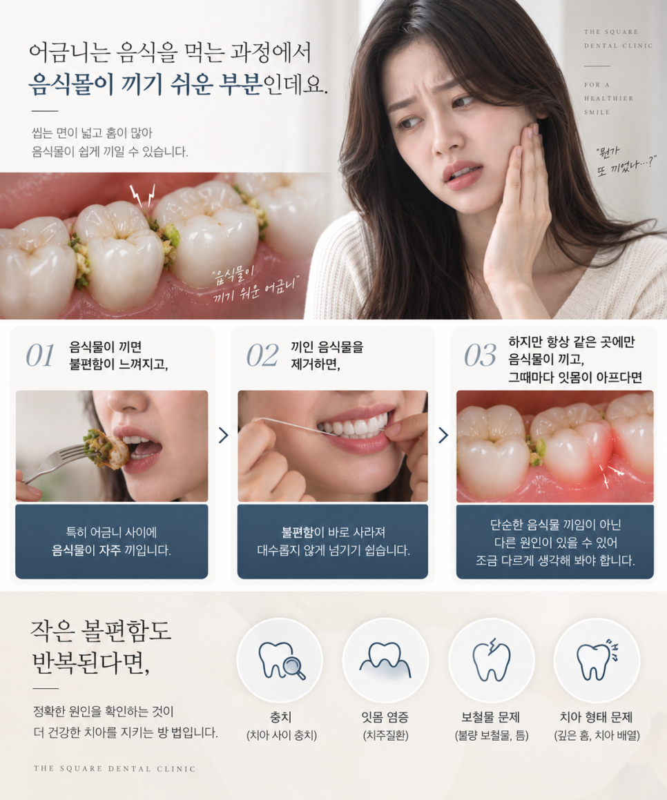 어금니잇몸통증, 잇몸이 욱신거린다면 확인할 3가지 관련 이미지 9