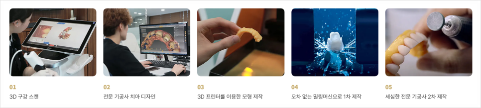 영구치 앞니 벌어짐 해결에 앞니미니쉬 VS 레진 VS 라미네이트 관련 이미지 13