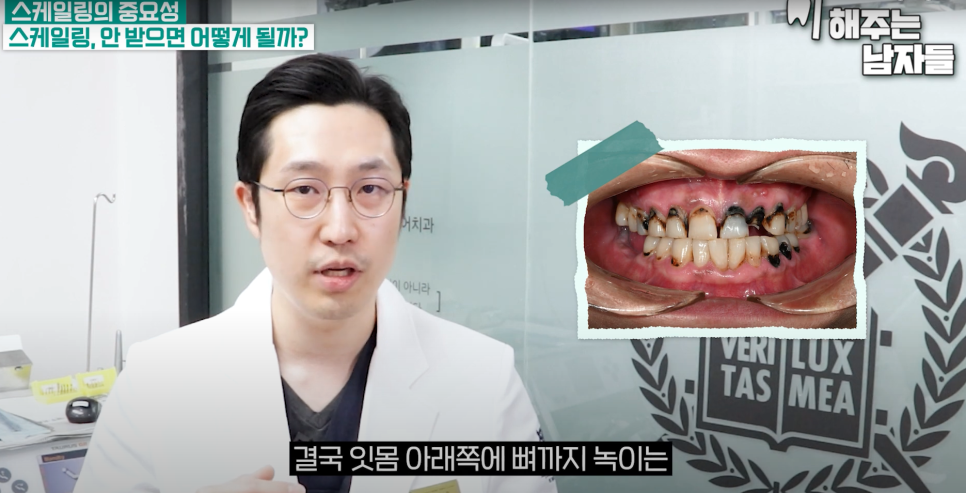 충정로역스케일링 조용히 무너지는 잇몸, 그 시작은 치석입니다 관련 이미지 2