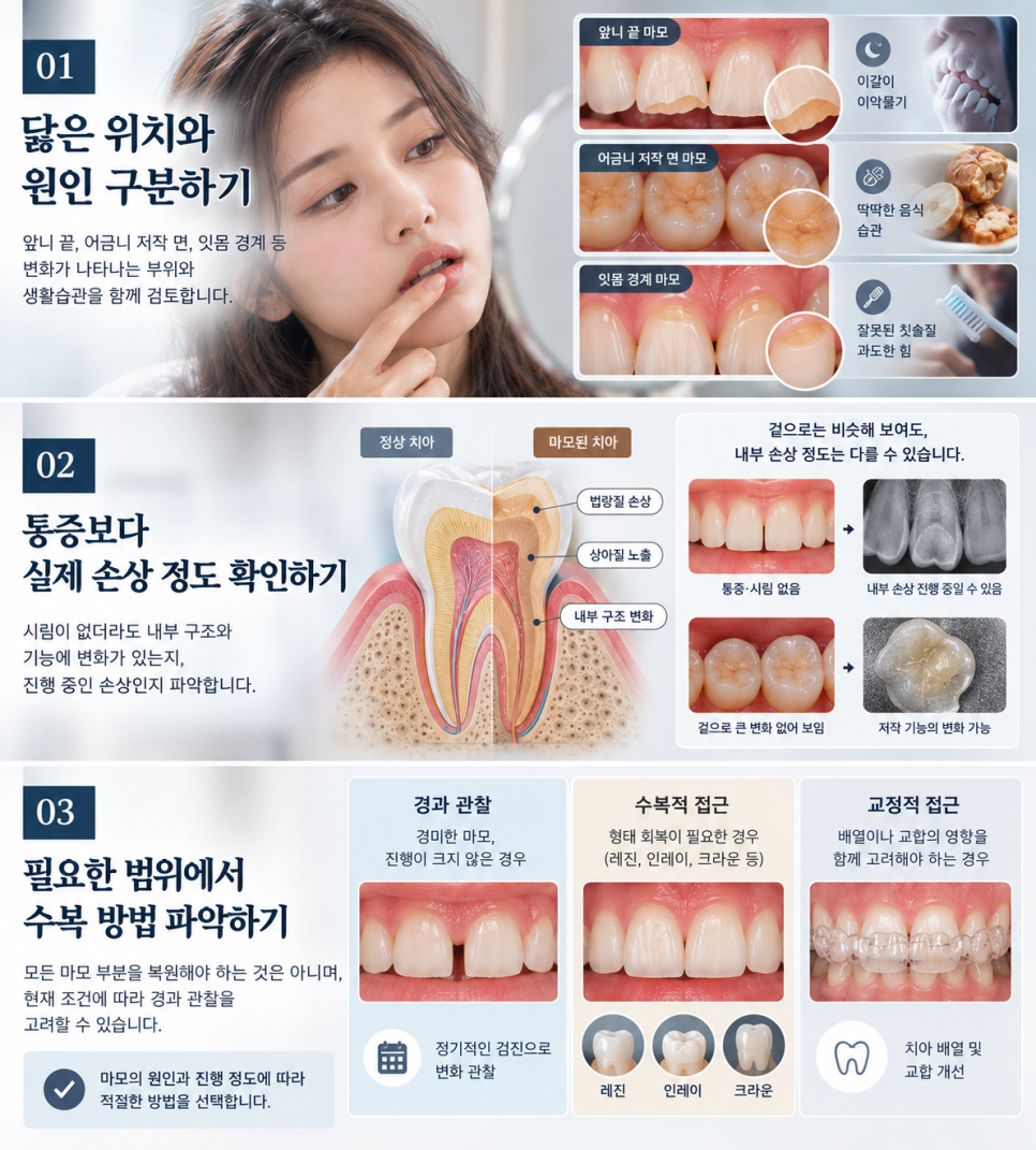 치아마모, 치아보존치료가 필요한 경우는? 관련 이미지 12