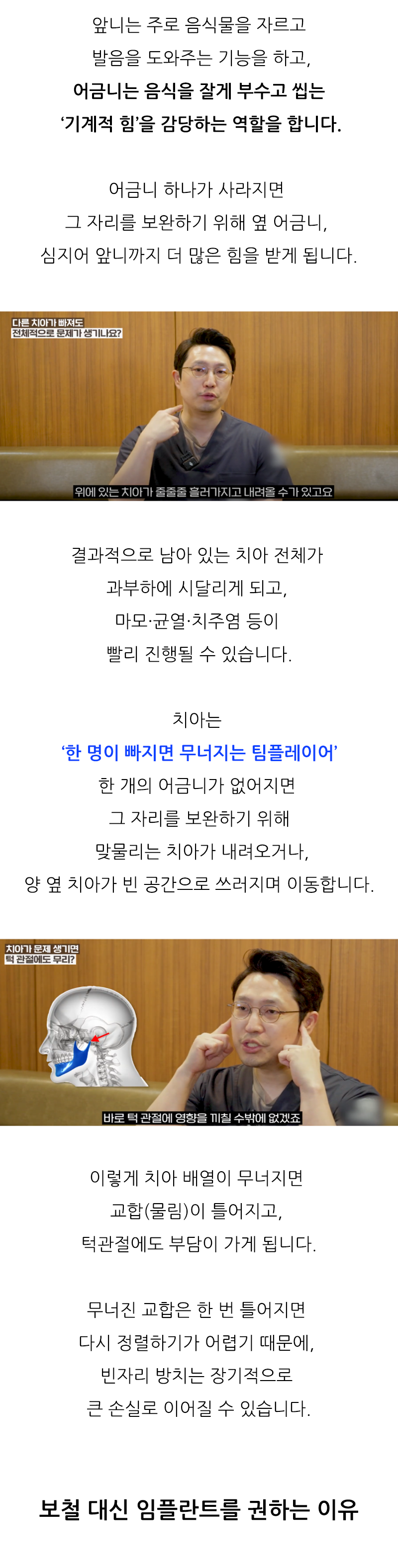 종각치과 어금니빠짐 안정적인 관리를 위해 관련 이미지 2