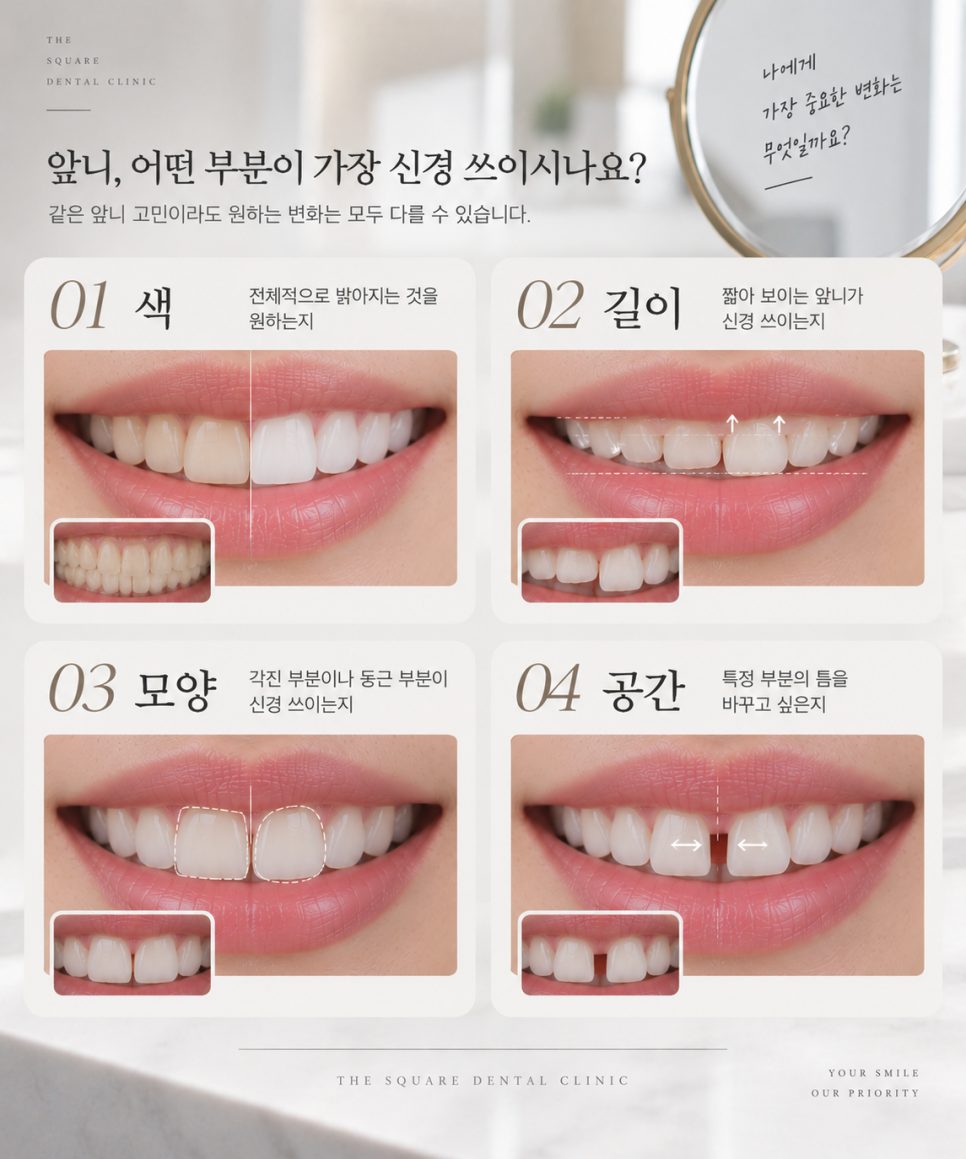치아 미니쉬, 앞니 한 개만 보면 될까? 광화문치과에서 알아보는 치료 범위 관련 이미지 10