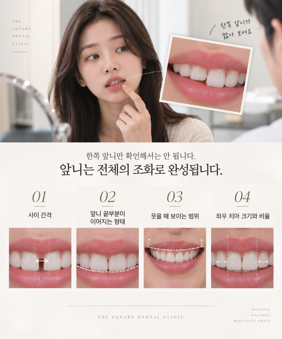 치아 미니쉬, 앞니 한 개만 보면 될까? 광화문치과에서 알아보는 치료 범위 관련 이미지 7