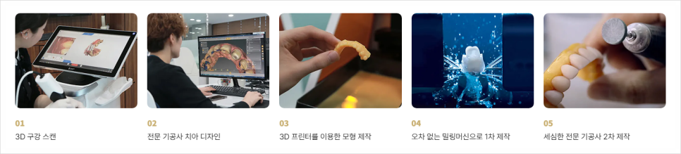 왜소치 교정, 작은 치아 무작정 키우기 전 알아야 할 팩트 관련 이미지 12