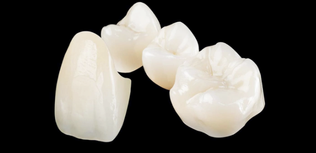 Crowns After Root Canal Treatment <When Root Canal Treatment Is Needed & Features of Each Crown Material> image 15