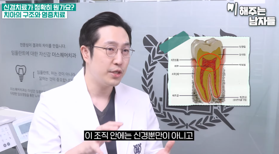 Practical Advice on Root Canal Treatment Duration & Tips for Avoiding Overtreatment image 4