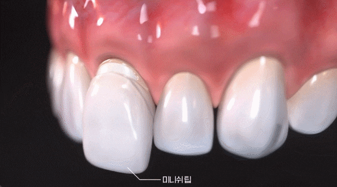 미니쉬치과의원 선택 전, 이 기준은 확인하셨나요? 관련 이미지 2