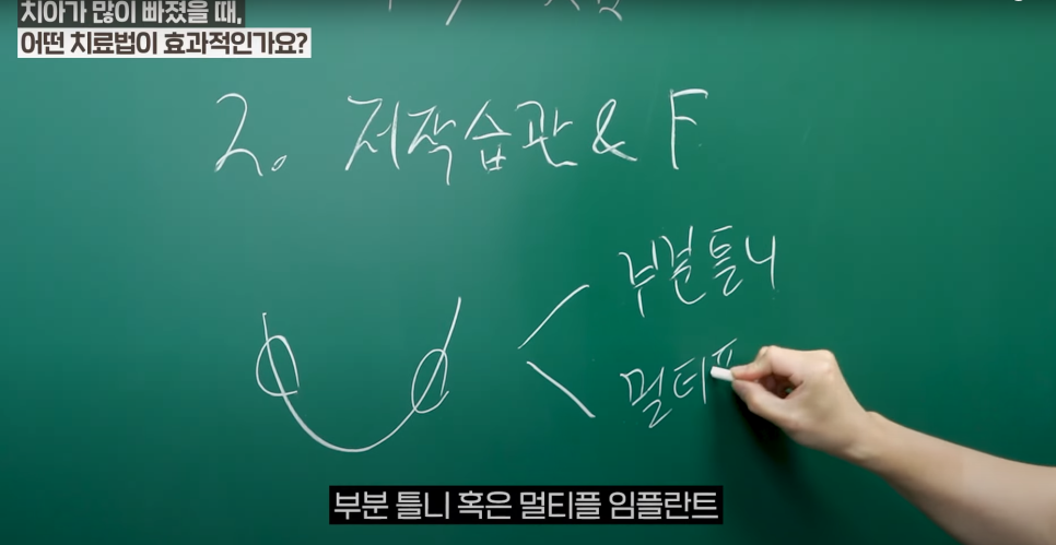 소곡동임플란트 치아가 몇 개만 빠졌을 때, 어떤 치료를 받아야할까? 관련 이미지 2