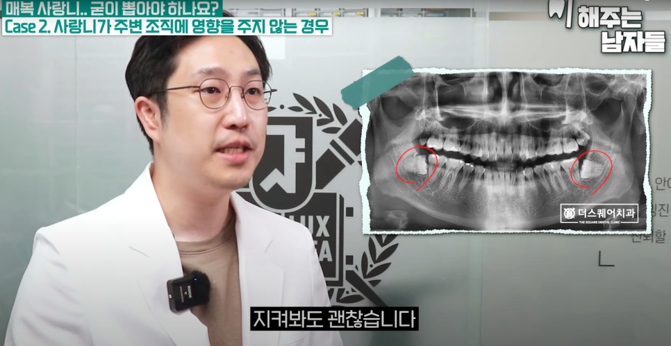 경복궁역사랑니, 안 보이는 사랑니도 발치가 필요한가요? 관련 이미지 10