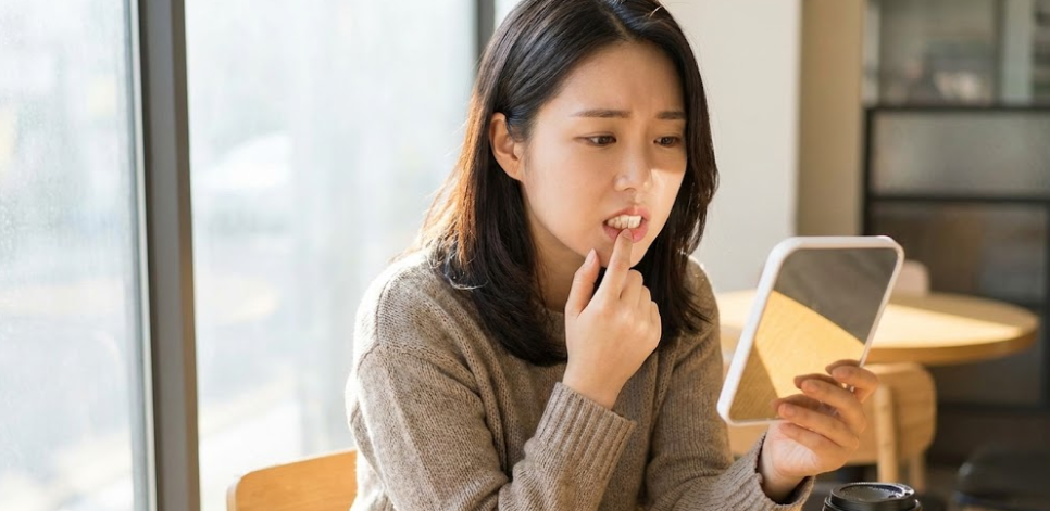앞니크랙 앞니 금 생겼을 때 치료 여부 정해드립니다 관련 이미지 1