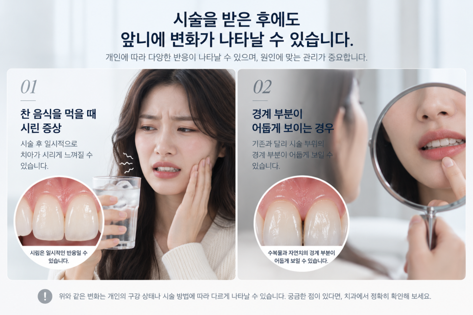 치아라미네이트, 충치 증상 있다면 먼저 확인할 것은? 관련 이미지 11
