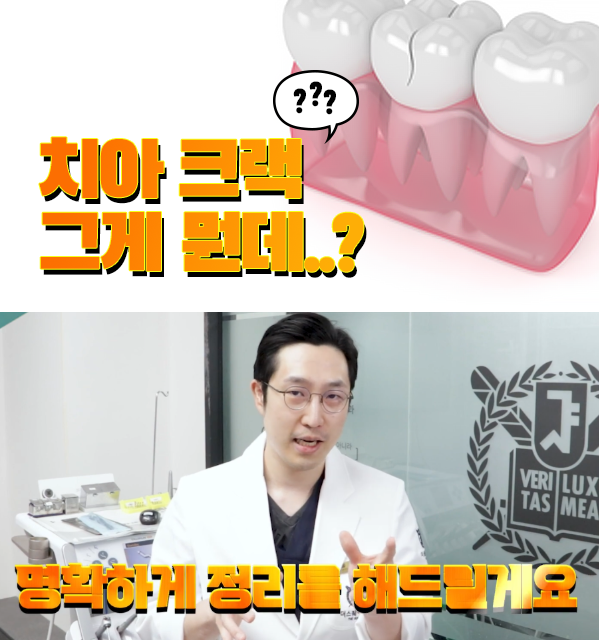 서울중구치과 치아 크랙, 그냥 지나치면 안됩니다 관련 이미지 1