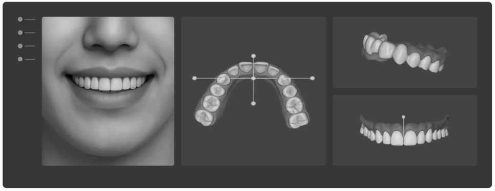 심미보철, 결과를 먼저 확인하고 결정합니다. [스마일리허설] 관련 이미지 5