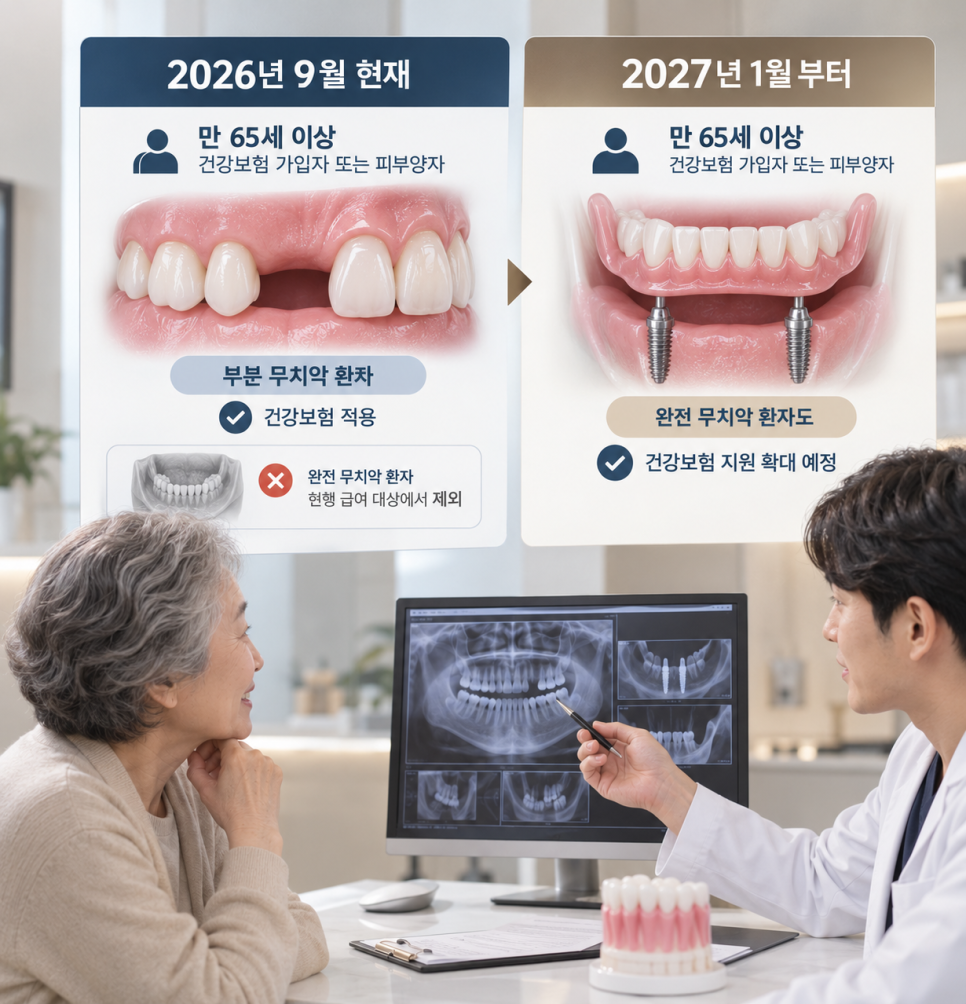 부모님 종로 임플란트 알아본다면, 보험부터 짚어보세요 관련 이미지 6