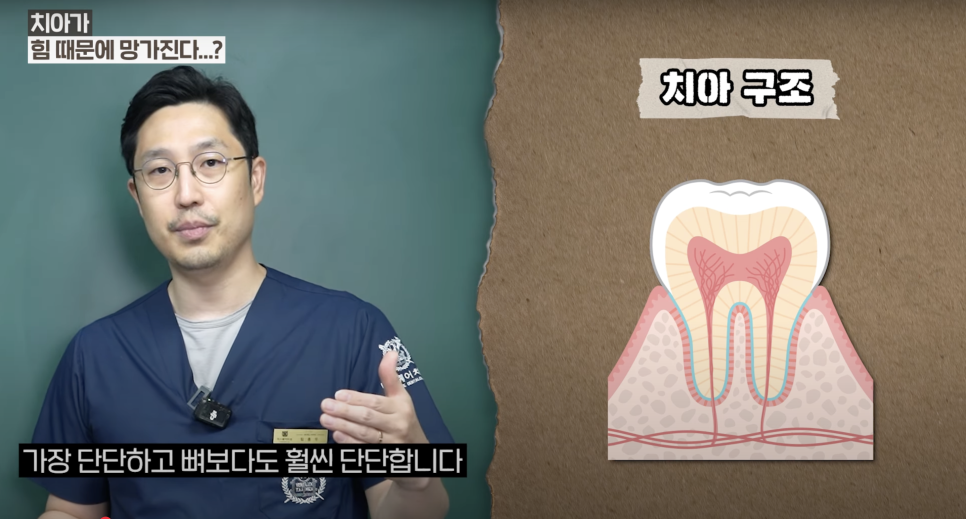명동임플란트, 충치 말고 꼭 의심해야 할 원인 관련 이미지 4