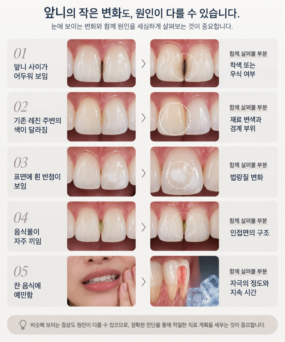 치아라미네이트, 충치 증상 있다면 먼저 확인할 것은? 관련 이미지 6