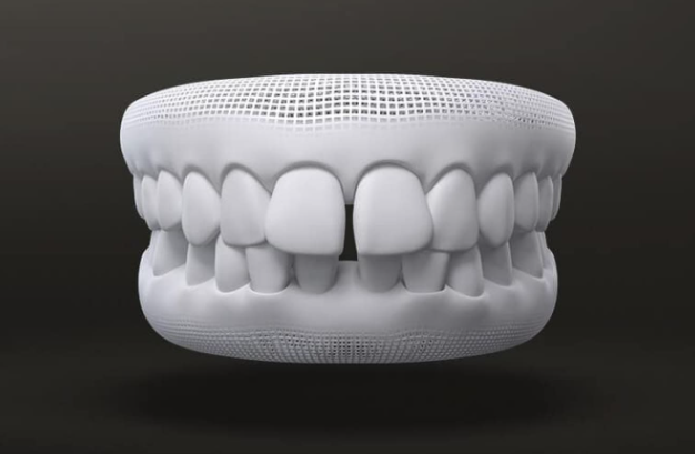 소아치아교정, 지금 시작해야 할까요? 관련 이미지 3