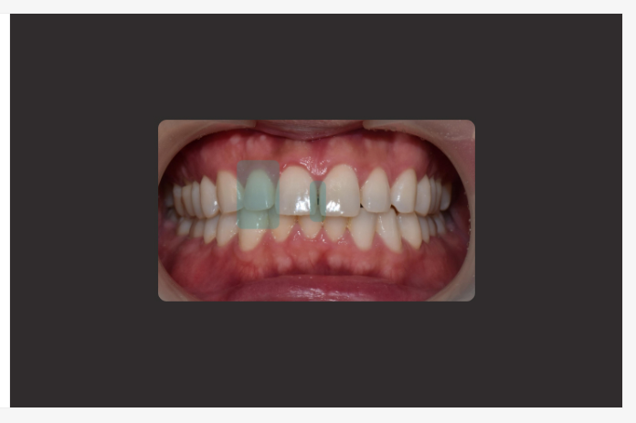 재교정, 다시 맞추기 전에 흐트러진 이유부터 확인하셔야 합니다. 관련 이미지 3