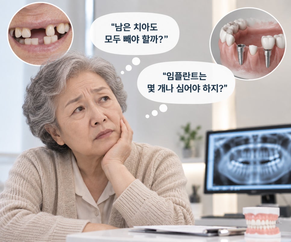 전체임플란트, 모두 발치해야 할까? 치과수면치료까지 알아보기 관련 이미지 2