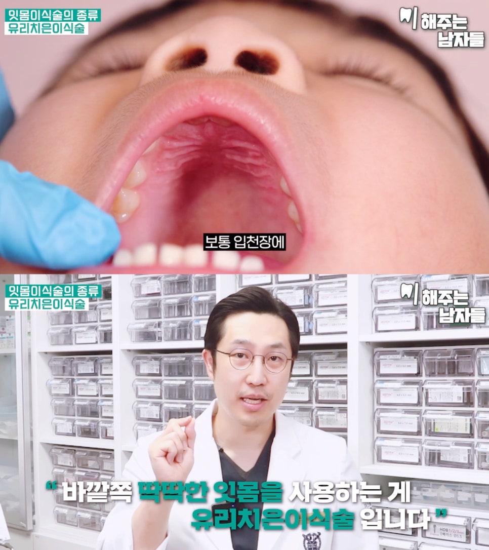 잇몸이식수술로 내려앉은 잇몸 다시 건강하게 채우는 법 관련 이미지 6