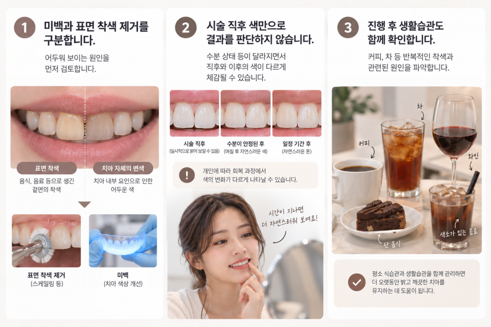 치과 치아미백 바로 밝아질까? 광화문 치과에서 확인할 3가지 관련 이미지 11