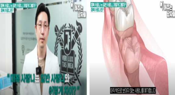 이대치과 매복사랑니, 꼭 발치해야 될까요 관련 이미지 2