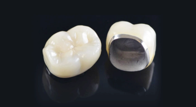 Crowns After Root Canal Treatment <When Root Canal Treatment Is Needed & Features of Each Crown Material> image 14