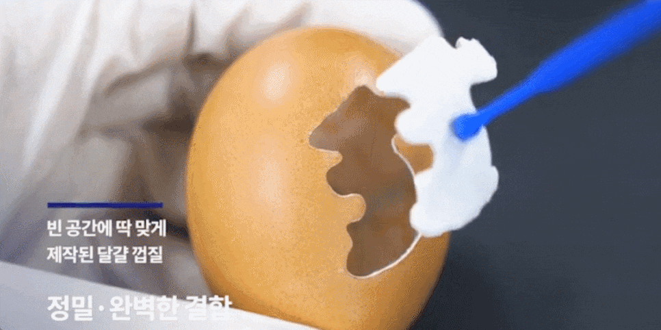 미니쉬치과의원 선택 전, 이 기준은 확인하셨나요? 관련 이미지 6