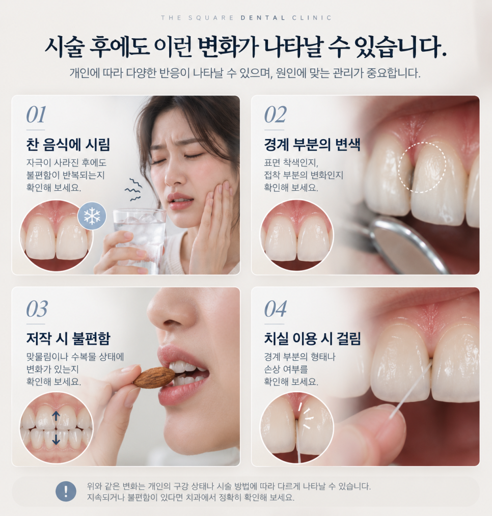 치아라미네이트, 충치 증상 있다면 먼저 확인할 것은? 관련 이미지 12