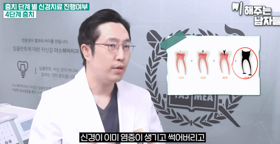 신경치료 vs 임플란트, 어떤 기준으로 나뉠까요? 관련 이미지 3