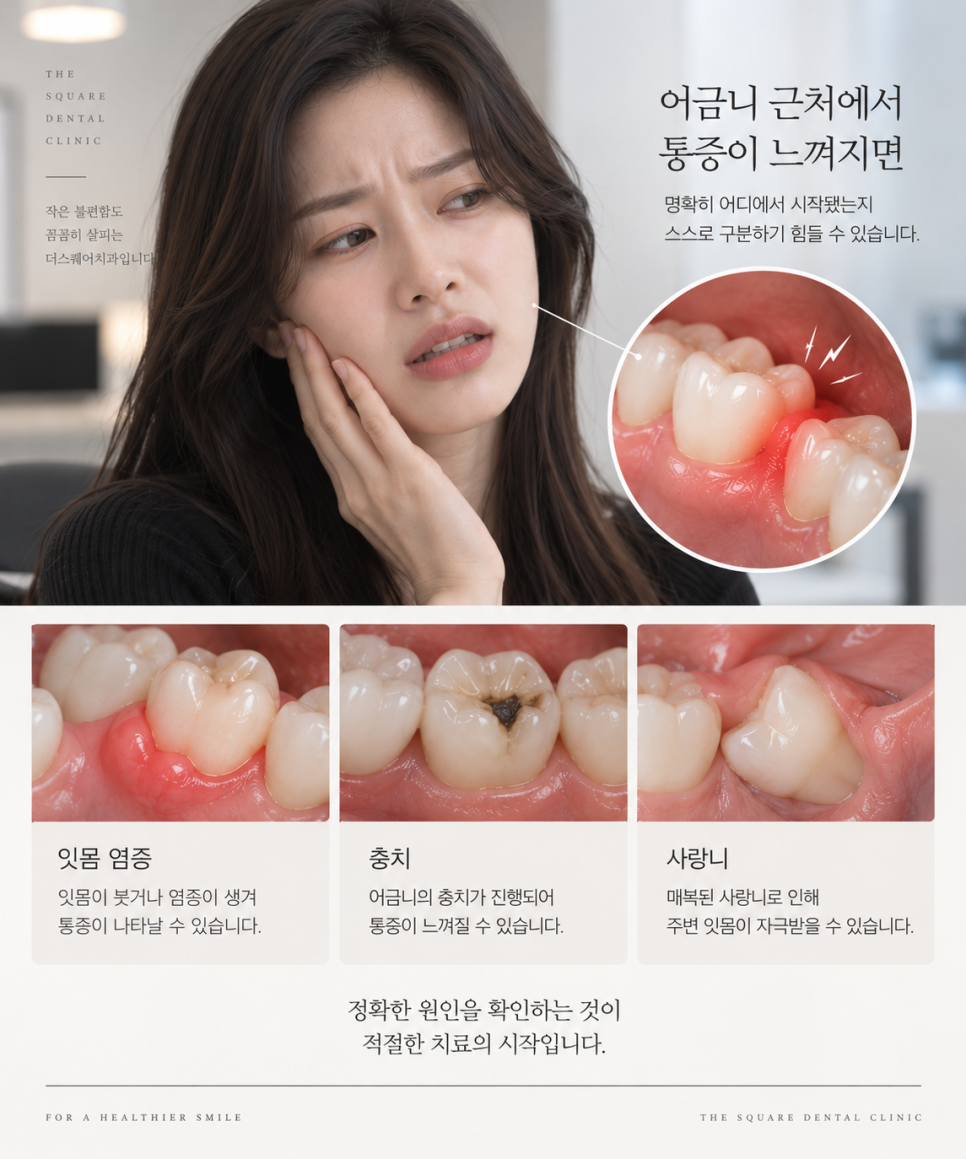 어금니잇몸통증, 잇몸이 욱신거린다면 확인할 3가지 관련 이미지 5